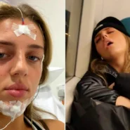 Young woman with narcolepsy reveals how she falls asleep anywhere - on dates, at work, even during exams - despite facing accusations of laziness and disbelief.