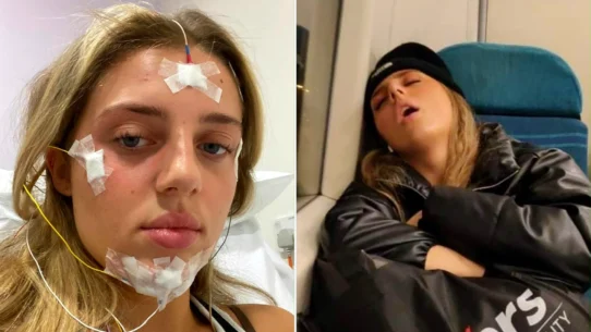 Young woman with narcolepsy reveals how she falls asleep anywhere - on dates, at work, even during exams - despite facing accusations of laziness and disbelief.
